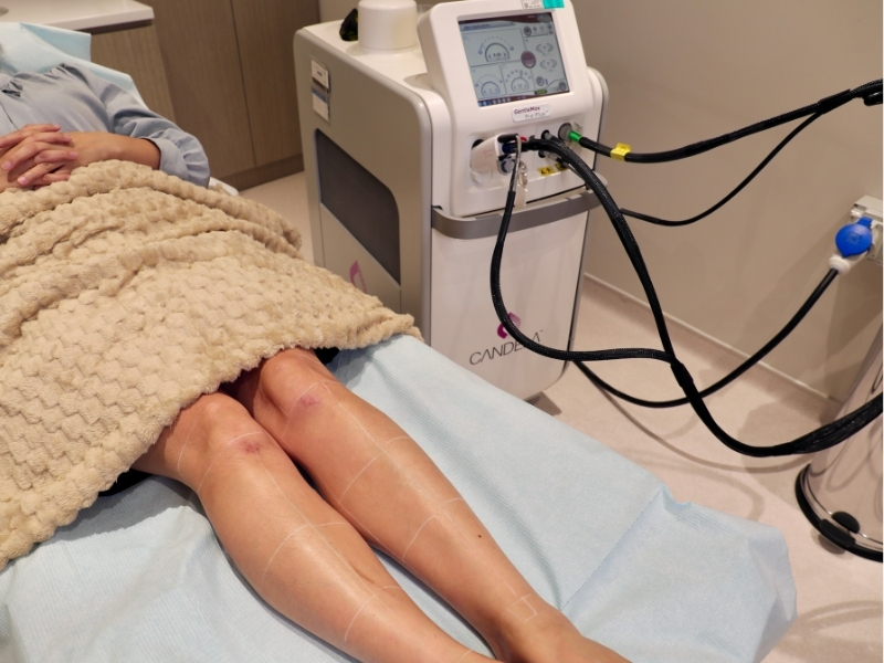 Hair Removal (1)