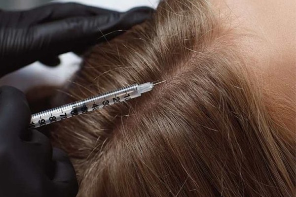 Stem Cell Hair Therapy in Abu Dhabi for Natural Hair Regrowth